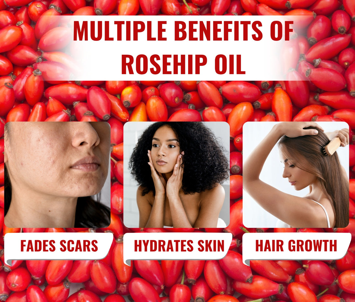 Cold Pressed Rosehip Oil for Glowing Skin, Reduces Fine Lines & Acne Scars